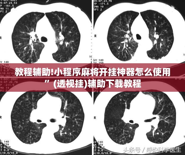 教程辅助!小程序麻将开挂神器怎么使用	”(透视挂)辅助下载教程