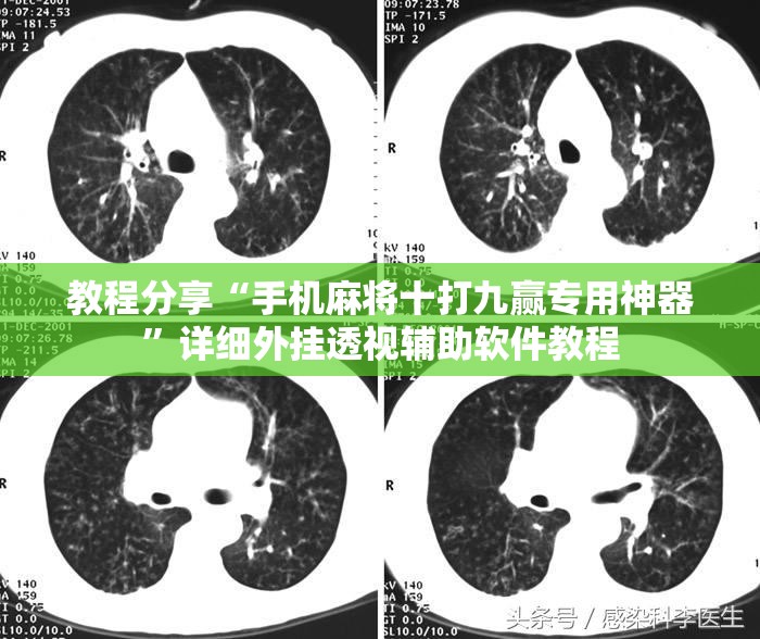 教程分享“手机麻将十打九赢专用神器”详细外挂透视辅助软件教程