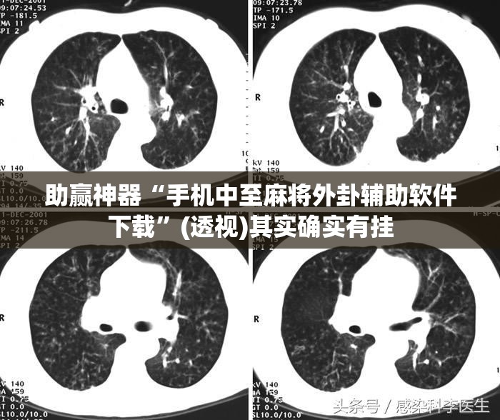 助赢神器“手机中至麻将外卦辅助软件下载”(透视)其实确实有挂