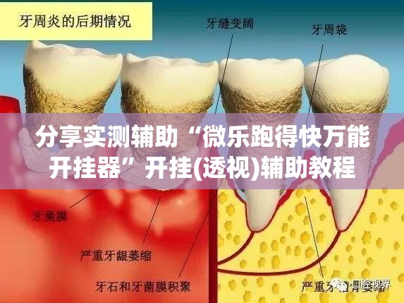 分享实测辅助“微乐跑得快万能开挂器	”开挂(透视)辅助教程