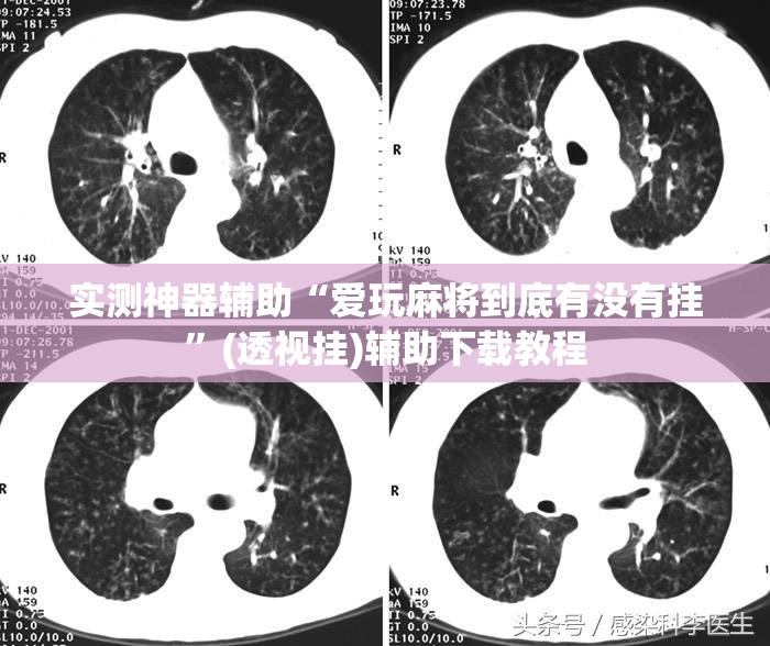 实测神器辅助“爱玩麻将到底有没有挂	”(透视挂)辅助下载教程